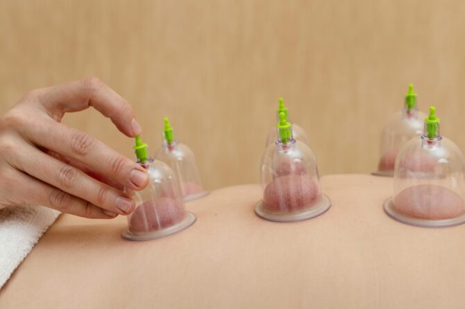 The Holistic Health Advantages of Hijama Therapy: Beyond Pain Alleviation